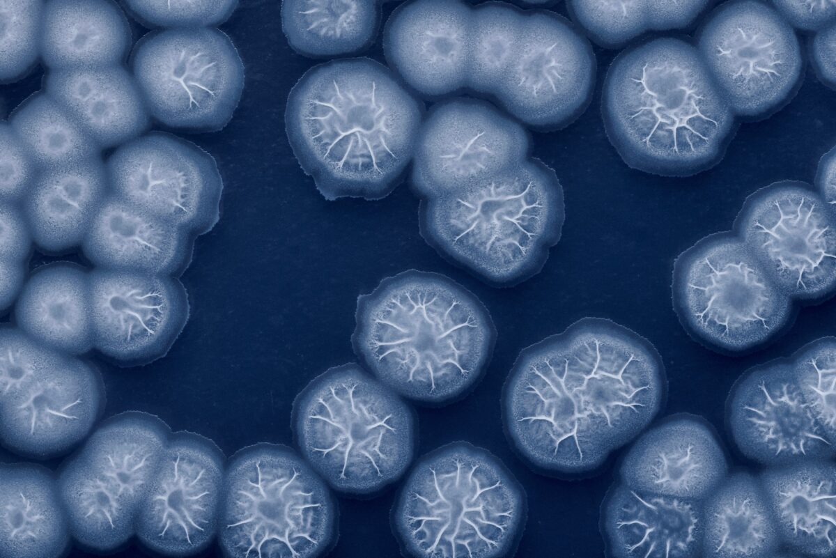 Bacterial colonies grown on agar plate (Bacillus subtilis)